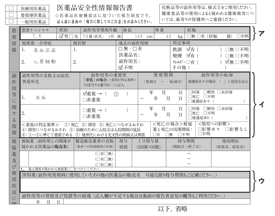 解説画像